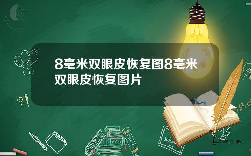 8毫米双眼皮恢复图8毫米双眼皮恢复图片