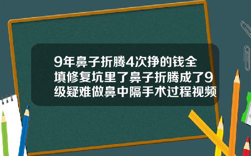 9年鼻子折腾4次挣的钱全填修复坑里了鼻子折腾成了9级疑难做鼻中隔手术过程视频