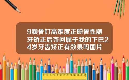 9颗骨钉高难度正畸骨性龅牙矫正后夺回属于我的下巴24岁牙齿矫正有效果吗图片