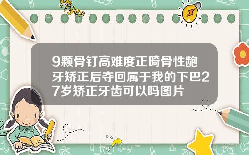 9颗骨钉高难度正畸骨性龅牙矫正后夺回属于我的下巴27岁矫正牙齿可以吗图片