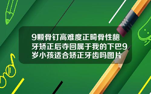 9颗骨钉高难度正畸骨性龅牙矫正后夺回属于我的下巴9岁小孩适合矫正牙齿吗图片