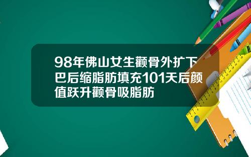98年佛山女生颧骨外扩下巴后缩脂肪填充101天后颜值跃升颧骨吸脂肪