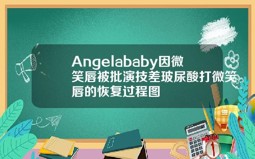 Angelababy因微笑唇被批演技差玻尿酸打微笑唇的恢复过程图
