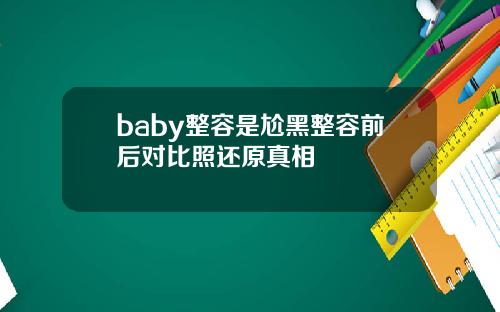 baby整容是尬黑整容前后对比照还原真相
