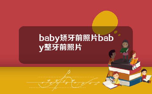 baby矫牙前照片baby整牙前照片