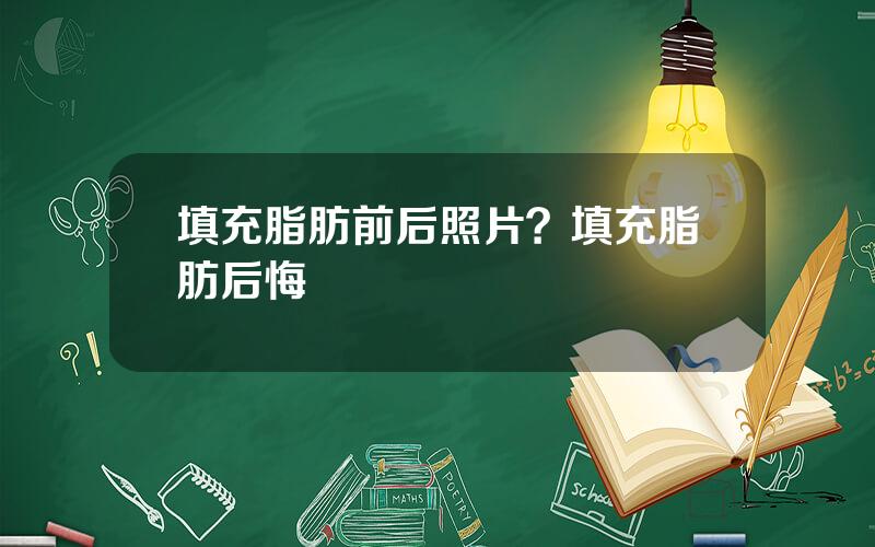 填充脂肪前后照片？填充脂肪后悔