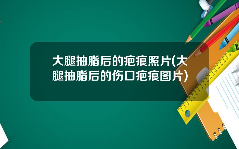 大腿抽脂后的疤痕照片(大腿抽脂后的伤口疤痕图片)