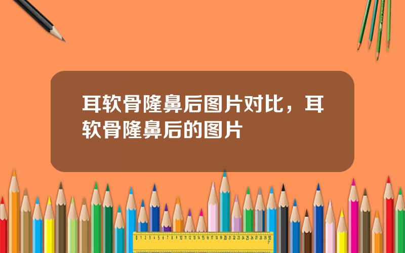 耳软骨隆鼻后图片对比，耳软骨隆鼻后的图片